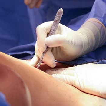 Dr. Jeffrey J. Roth holding a surgical knife