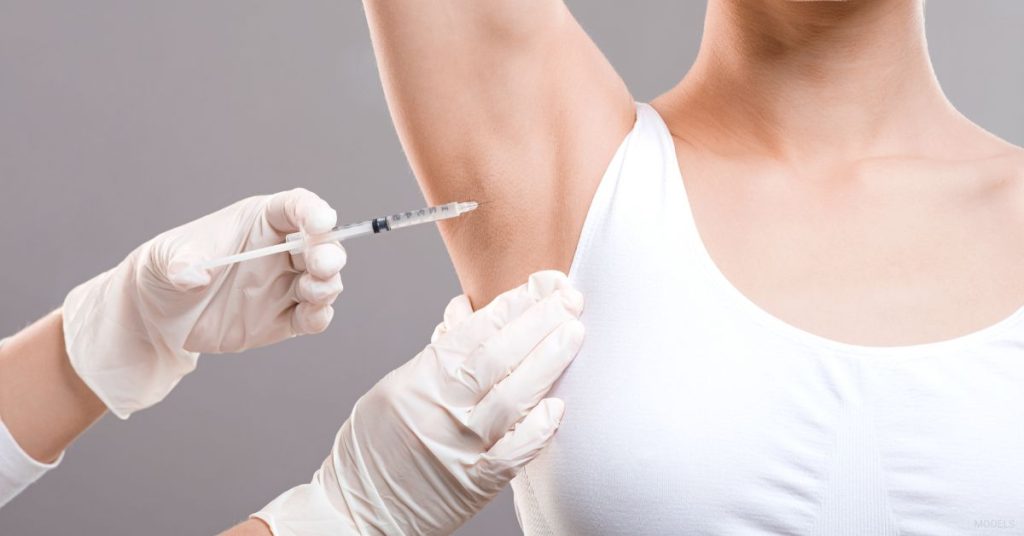Patient receiving BOTOX® for Hyperhidrosis. (Models)